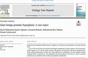 Giant benign prostatic hyperplasia: A case report